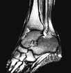 Human Ankle X Ray
